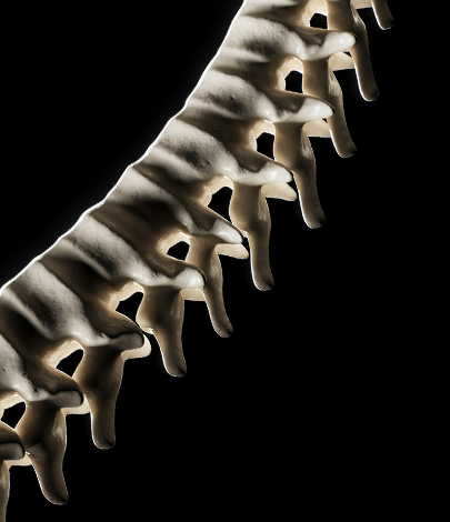 OSTEOPOROSIS-SYMPTOMS-Main