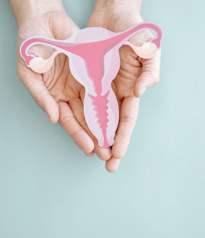 DEXA PCOS